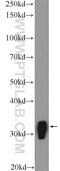 Myristoylated Alanine Rich Protein Kinase C Substrate antibody, 51087-1-AP, Proteintech Group, Western Blot image 