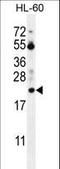 PTMA antibody, LS-C162288, Lifespan Biosciences, Western Blot image 