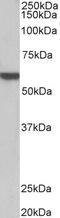 Adrenoceptor Alpha 1B antibody, STJ72936, St John