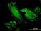 40S ribosomal protein S7 antibody, orb89674, Biorbyt, Immunocytochemistry image 