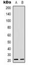 Ras Homolog Family Member G antibody, LS-C368721, Lifespan Biosciences, Western Blot image 