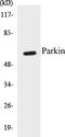 Parkin RBR E3 Ubiquitin Protein Ligase antibody, EKC1440, Boster Biological Technology, Western Blot image 