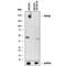 DNA topoisomerase 2-beta antibody, AF6348, R&D Systems, Western Blot image 