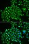 Recoverin antibody, LS-C334690, Lifespan Biosciences, Immunofluorescence image 