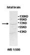Zinc Finger Protein 132 antibody, orb77976, Biorbyt, Western Blot image 