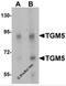 Transglutaminase 5 antibody, 6537, ProSci Inc, Western Blot image 