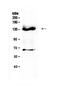 Fms Related Tyrosine Kinase 3 antibody, PA5-79269, Invitrogen Antibodies, Western Blot image 