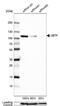 Upstream Binding Transcription Factor antibody, NBP1-82545, Novus Biologicals, Western Blot image 