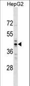 TRNA Methyltransferase 10A antibody, LS-C158839, Lifespan Biosciences, Western Blot image 
