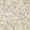 Thioredoxin Like 1 antibody, LS-C334639, Lifespan Biosciences, Immunohistochemistry paraffin image 