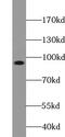 Transient Receptor Potential Cation Channel Subfamily C Member 4 Associated Protein antibody, FNab09016, FineTest, Western Blot image 