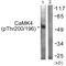 Calcium/Calmodulin Dependent Protein Kinase Kinase 1 antibody, PA5-38435, Invitrogen Antibodies, Western Blot image 