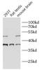 ST6 N-Acetylgalactosaminide Alpha-2,6-Sialyltransferase 5 antibody, FNab08271, FineTest, Western Blot image 