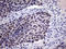 TRNA Splicing Endonuclease Subunit 34 antibody, LS-C792361, Lifespan Biosciences, Immunohistochemistry paraffin image 