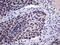 tRNA-splicing endonuclease subunit Sen34 antibody, LS-C792361, Lifespan Biosciences, Immunohistochemistry paraffin image 