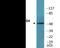 Programmed Cell Death 4 antibody, EKC2325, Boster Biological Technology, Western Blot image 