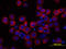 Interleukin 6 Signal Transducer antibody, MAB4681, R&D Systems, Immunocytochemistry image 