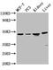 Hepsin antibody, CSB-PA010704LA01HU, Cusabio, Western Blot image 