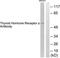 Thyroid Hormone Receptor Alpha antibody, TA313020, Origene, Western Blot image 