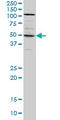 SYT4 antibody, LS-C198295, Lifespan Biosciences, Western Blot image 