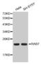 RAB7A, Member RAS Oncogene Family antibody, MBS125316, MyBioSource, Western Blot image 