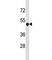 Tumor necrosis factor receptor superfamily member 25 antibody, F45569-0.4ML, NSJ Bioreagents, Western Blot image 