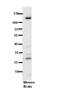 N-6 Adenine-Specific DNA Methyltransferase 1 antibody, PA5-42782, Invitrogen Antibodies, Western Blot image 