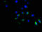 Activin A Receptor Type 1B antibody, LS-C375145, Lifespan Biosciences, Immunofluorescence image 