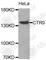 CTR9 Homolog, Paf1/RNA Polymerase II Complex Component antibody, A3659, ABclonal Technology, Western Blot image 