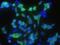 Cellular Retinoic Acid Binding Protein 2 antibody, GTX02001, GeneTex, Immunofluorescence image 