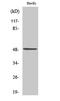 Inositol Hexakisphosphate Kinase 2 antibody, STJ93747, St John