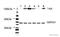 Neurotrophic Receptor Tyrosine Kinase 1 antibody, ab76291, Abcam, Western Blot image 