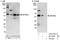 Zinc Finger And BTB Domain Containing 8A antibody, A303-241A, Bethyl Labs, Immunoprecipitation image 