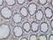 Spastin antibody, H00006683-M02, Novus Biologicals, Immunohistochemistry paraffin image 