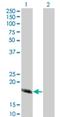 Calcium Binding Protein 4 antibody, H00057010-M02, Novus Biologicals, Western Blot image 