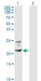 Bone Marrow Stromal Cell Antigen 2 antibody, H00000684-M02, Novus Biologicals, Western Blot image 