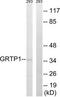 Growth Hormone Regulated TBC Protein 1 antibody, TA326248, Origene, Western Blot image 