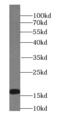 Plasmolipin antibody, FNab06524, FineTest, Western Blot image 