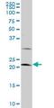 Large Tumor Suppressor Kinase 1 antibody, H00009113-M09, Novus Biologicals, Western Blot image 