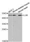 Lymphotoxin Beta Receptor antibody, MBS2529994, MyBioSource, Western Blot image 