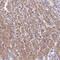 Exocyst Complex Component 6B antibody, PA5-64145, Invitrogen Antibodies, Immunohistochemistry paraffin image 