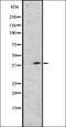Collagen Type VII Alpha 1 Chain antibody, orb337697, Biorbyt, Western Blot image 