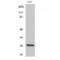 Hydroxysteroid 17-Beta Dehydrogenase 10 antibody, LS-C383395, Lifespan Biosciences, Western Blot image 