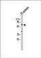 Proteolipid Protein 1 antibody, orb131678, Biorbyt, Western Blot image 