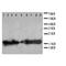 NME/NM23 Nucleoside Diphosphate Kinase 2 antibody, orb76343, Biorbyt, Western Blot image 