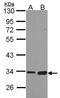 Monoglyceride Lipase antibody, PA5-27915, Invitrogen Antibodies, Western Blot image 