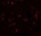 Cysteine and histidine-rich domain-containing protein 1 antibody, A08593, Boster Biological Technology, Immunofluorescence image 