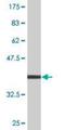 Nuclear Cap Binding Protein Subunit 1 antibody, H00004686-M04, Novus Biologicals, Western Blot image 