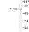 Activating Transcription Factor 6 Beta antibody, LS-C176831, Lifespan Biosciences, Western Blot image 