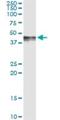 Platelet Derived Growth Factor D antibody, H00080310-M09, Novus Biologicals, Immunoprecipitation image 